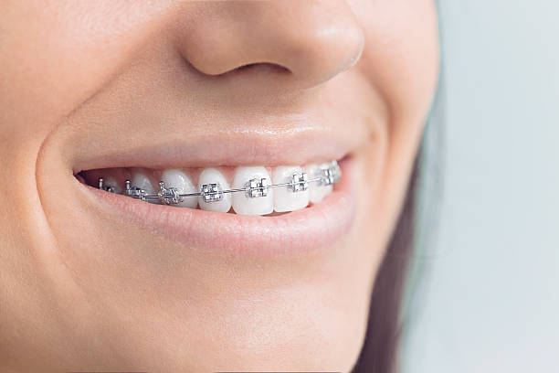 Best Veneers and Lumineers  in Crothersville, IN